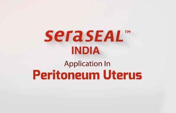 Peritoneum Uterus Surgery