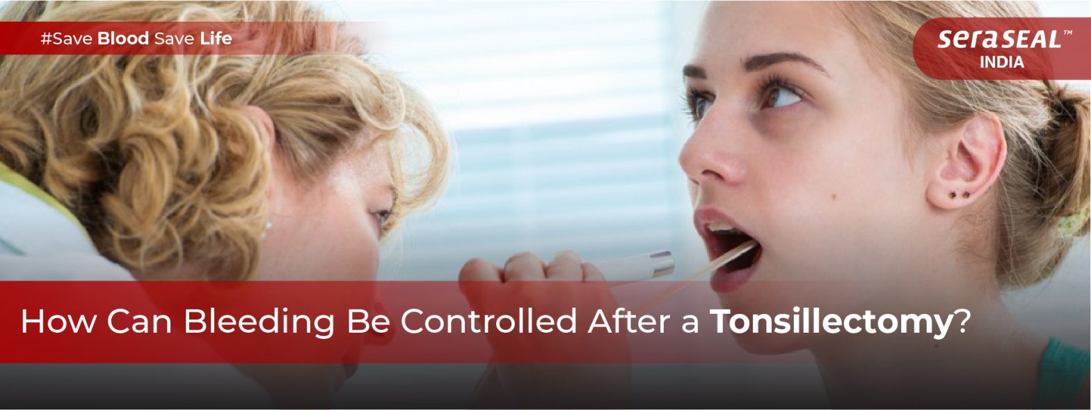 How Can Bleeding Be Controlled After a Tonsillectomy?